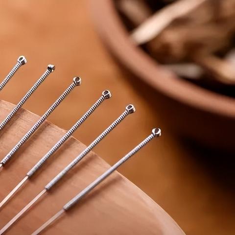 针灸医学奥秘揭秘，疾病治疗的广泛领域与独特魅力